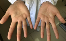 手胖之谜：揭秘沟通障碍背后的真相